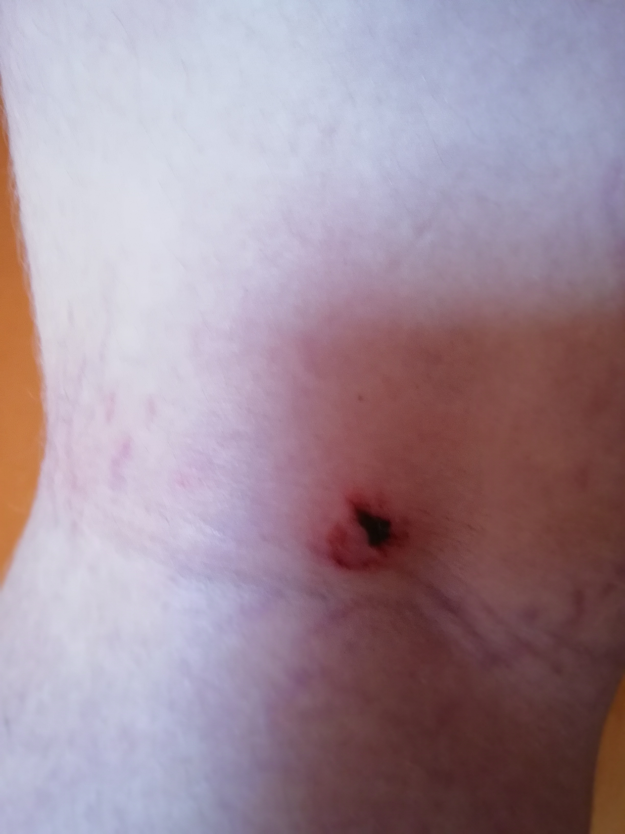 Psy z Dzikowca zaatakowały dziecko - Zdjęcie główne