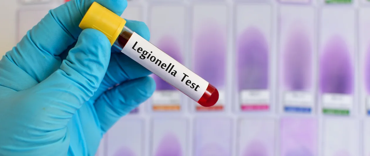 Region. Legionella u nas? - Zdjęcie główne